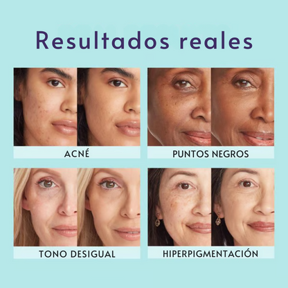 Crema Corporal: cubre manchas e imperfecciones | Piel radiante y natural | Resistente al sudor o agua | Aprovecha HOY producto en tendencia  💥