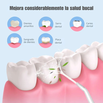 Irrigador Oral Limpieza Dental: Elimina el Sarro y Limpia profundamente 🦷