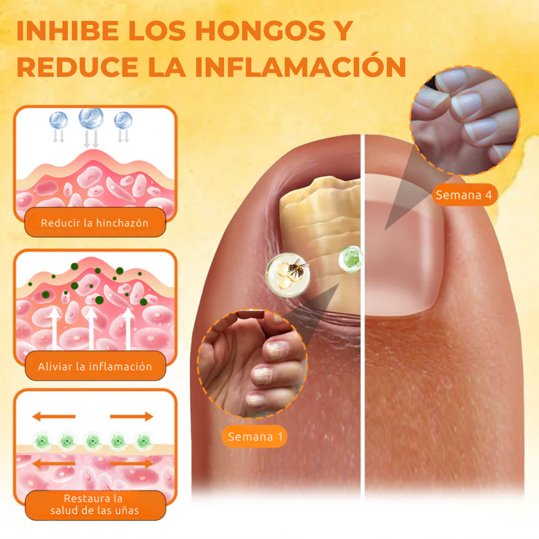 Spray reparador de uñas Fórmula Alemana | Elimina el hongo de tus uñas hasta su raíz – uñas limpias, fuertes y recuperadas en solo 4 semanas | PROMO HOY 2X1 🛒
