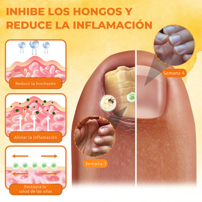 Spray reparador de uñas Fórmula Alemana | Elimina el hongo de tus uñas hasta su raíz – uñas limpias, fuertes y recuperadas en solo 4 semanas | PROMO HOY 2X1 🛒