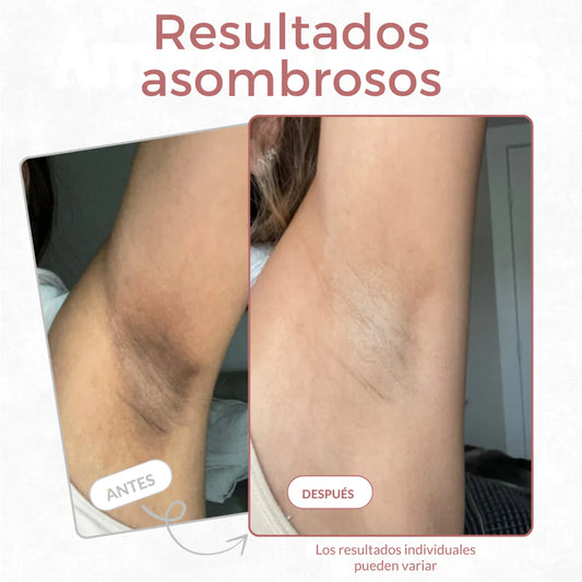 Spray Exfoliante Dr Melaxin: Aclara, Suaviza y Renueva Tu Piel 🌿