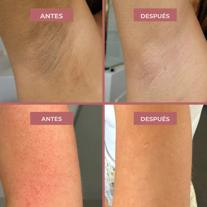 Spray Exfoliante Dr Melaxin: Aclara, Suaviza y Renueva Tu Piel 🌿