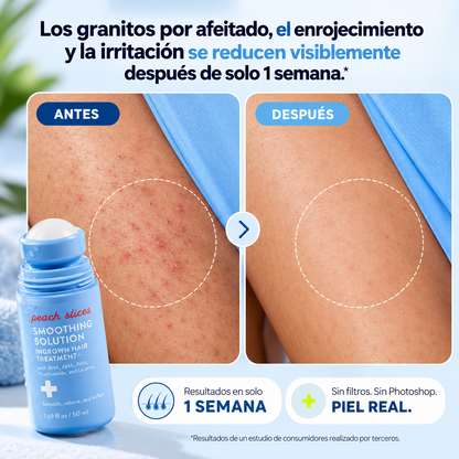 PEACH SLICES™️ | TRATAMIENTO RENOVADOR POST-DEPILACIÓN