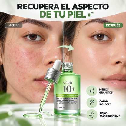ANUA 10+ | SERUM ACIDO AZELAICO 🌿