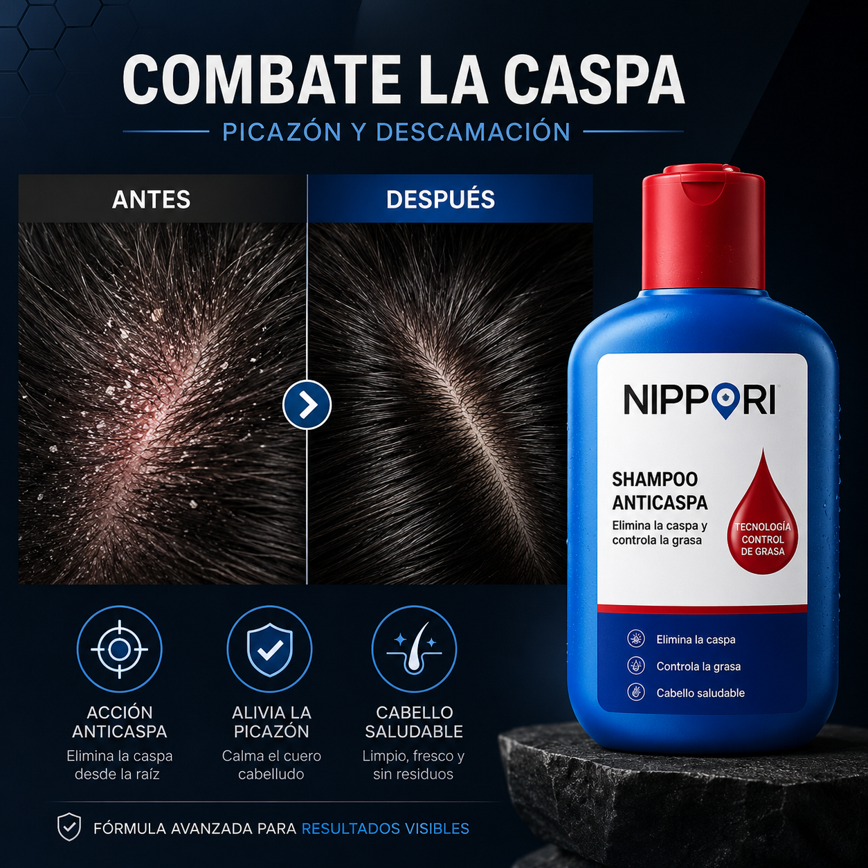 Shampoo NIPPORI Anticaspa: Elimina la Caspa y Controla la Grasa de tu Cabello
